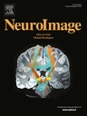 neuroImage