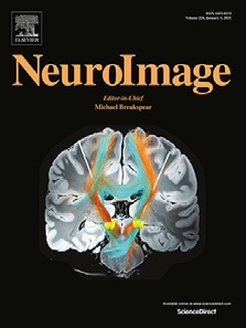 neuroImage