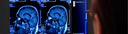 BION_Measure.PNG