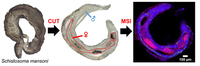 Schistosoma