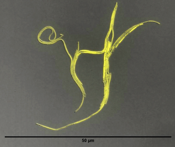 Cells of Rhodobacter sphaeroides