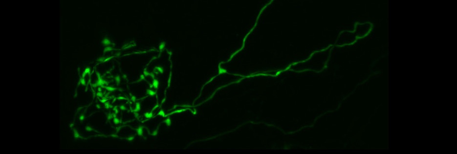 glomerulus.jpg