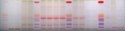 Anthocyane