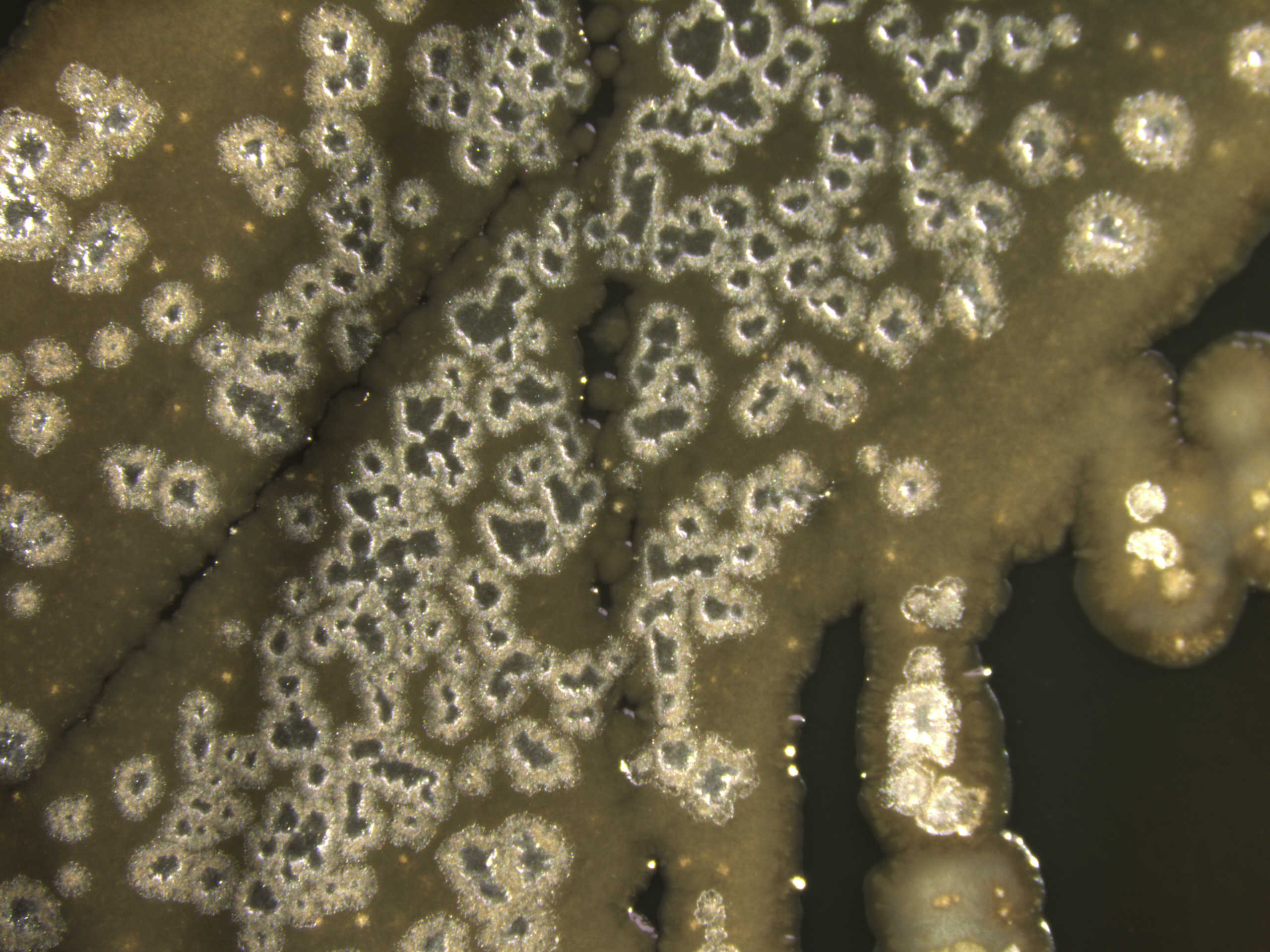 Pseudomonas aeruginosa