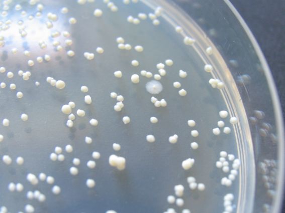 Mycobacterium avium ssp. paratuberculosis