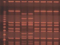 S. aureus PFGE