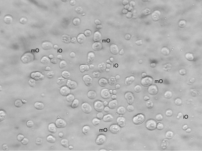 oocytes-bf-C.jpg