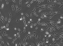 Mesenchymale Stammzellen vom Pferd in der Zellkultur in der Phasenkontrastmikroskopie