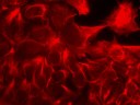 Stammzellen aus der humanen Amnionflüssigkeit, Expression von Vimentin
