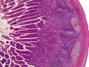 ileum katzebeK.tif