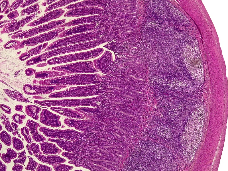 ileum katzebeK.tif