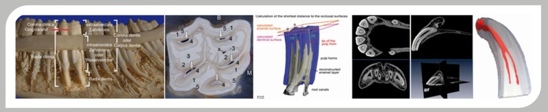 cavum dentis