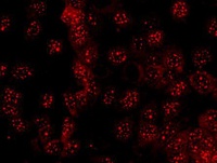 Diagnostik Untersuchungsverfahren Immunfluoreszenz