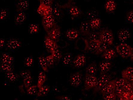 Diagnostik Untersuchungsverfahren Immunfluoreszenz