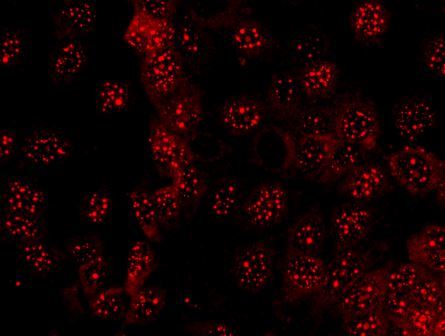 Diagnostik Untersuchungsverfahren Immunfluoreszenz