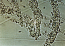Isolierter Plexus myentericus