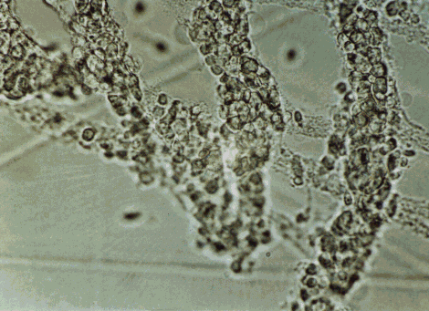 Isolierter Plexus myentericus