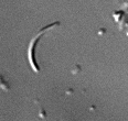 Actin-1-mutant.gif