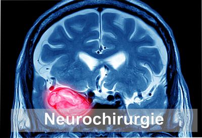 Neurochirurgie