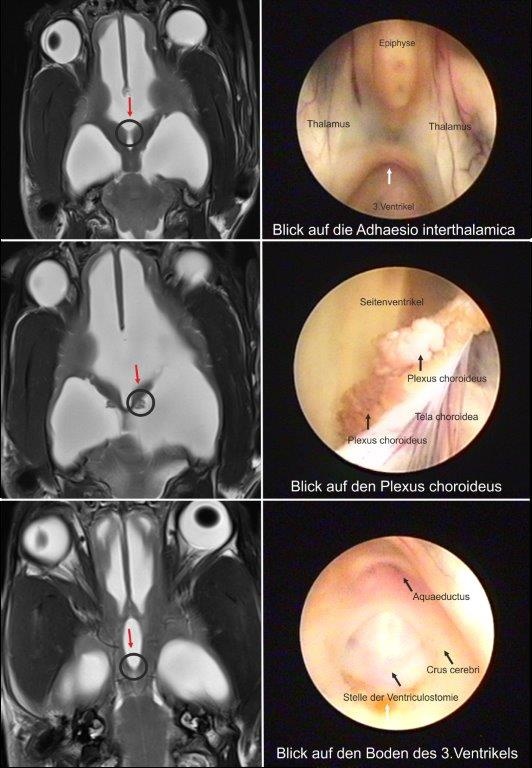 Neuroendoskopie bei Hydrocephalus Hund