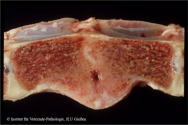 Diskospondylitis