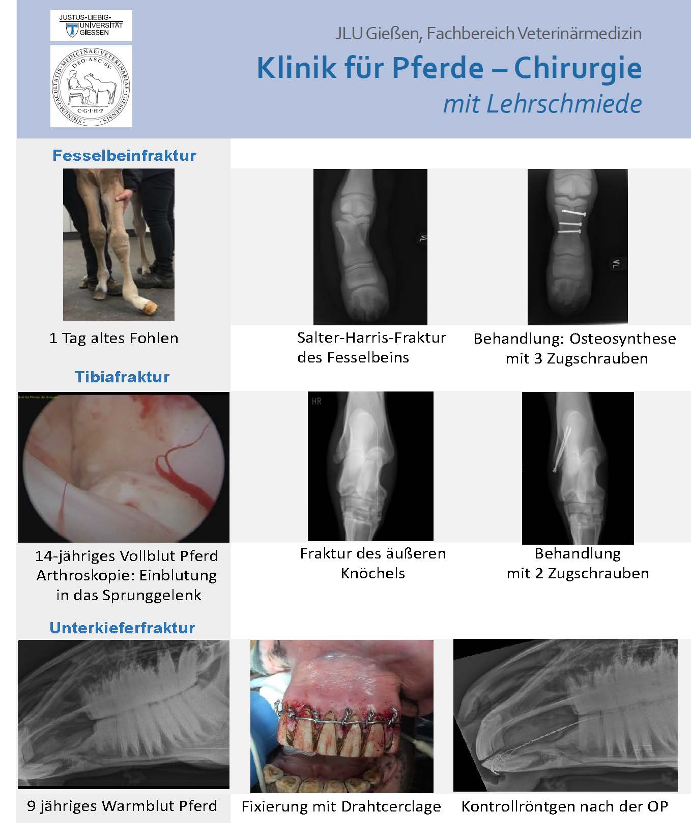 Bild Flyer Frakturversorgung