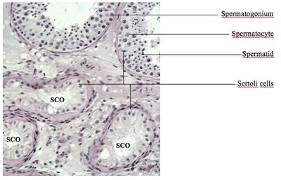 parasection parasection