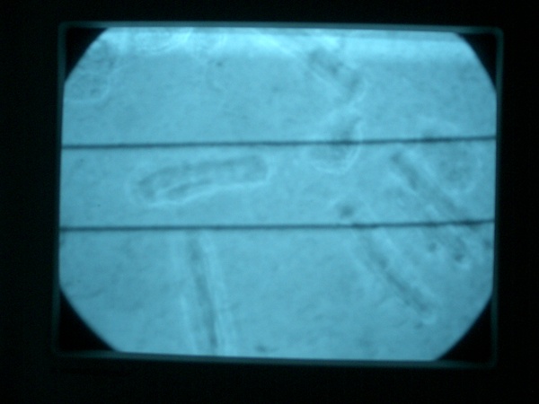 zappelzirkusmyocyte.JPG