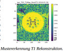 mustererkennung-t1-rekonstruktion.png