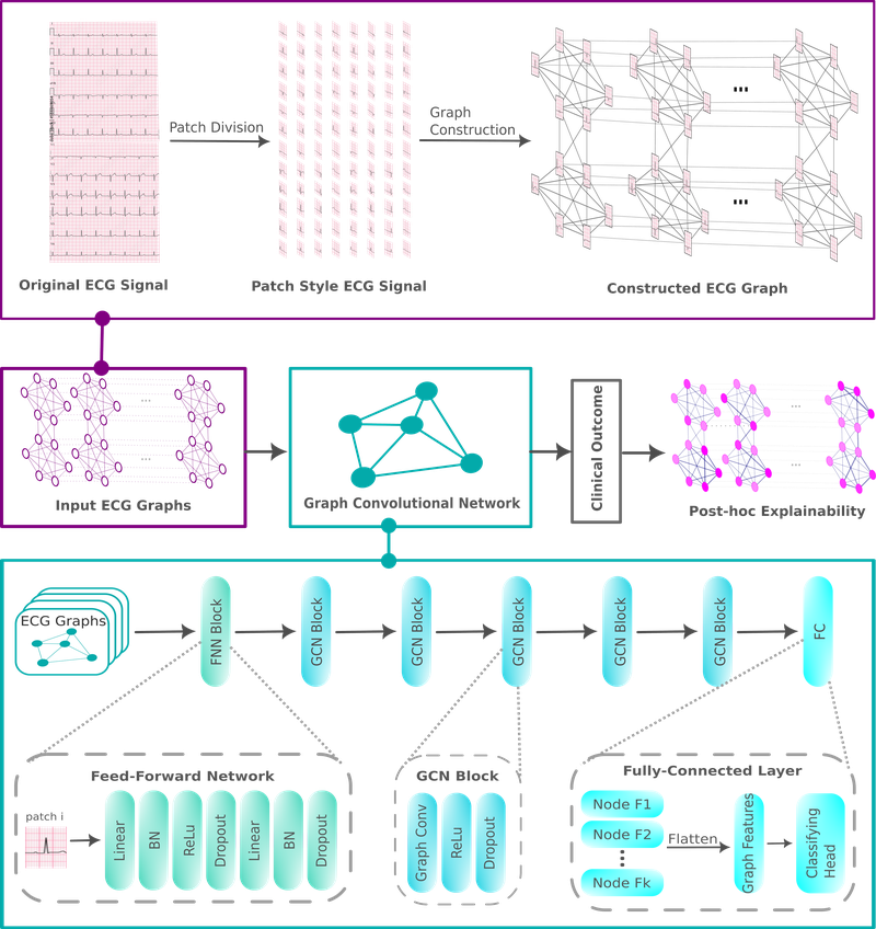 patching-in-graph-based-ecg-classification-medium.png
