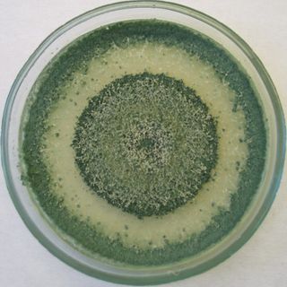 Ojo