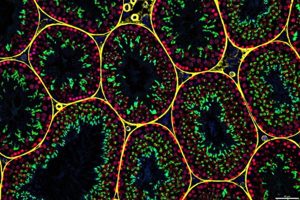 Fluorescence microscopy image of mouse testicular tissue