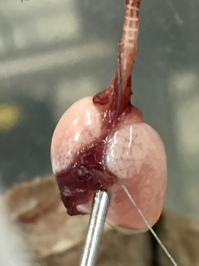 Jamal_Reshma_The isolated lungs .jpg