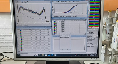 qPCR