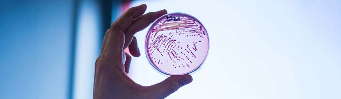 Virologie A hand is holding a used petri dish.