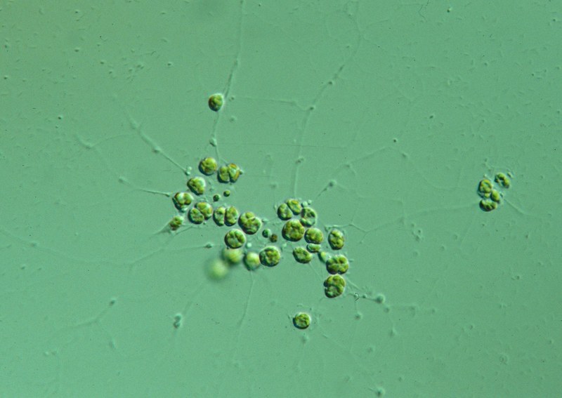 Zweite Algenart mit rätselhaften Chloroplasten-Komplexen entdeckt