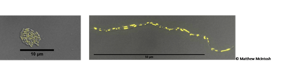 Die Wildtyp-Zellen des Bakteriums Rhodobacter sphaeroides (Abbildung links) wurden mittels der neuen Technik ACIT modifiziert, um die Zellgröße zu erhöhen. In den vergrößerten Zellen (Abbildung rechts) ist gelb die Anhäufung des abgelagerten Energiespeichermoleküls Polyhydroxybutyrat (PHB) sichtbar, das als Grundlage für biologisch abbaubare Kunststoffe dient.  Fotos: Matthew McIntosh