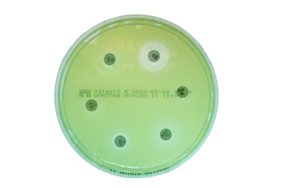 Resistenzprüfung mittels Agardiffusionstest: Agarplatte mit Pseudomonas Stamm, Foto: LMU Klinikum