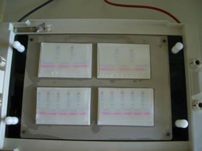 Immunoblot 1