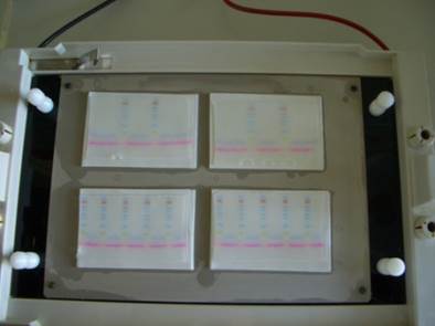 Immunoblot 1