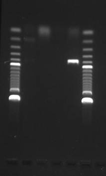 Diagnostik Untersuchungsverfahren PCR