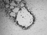 Diagnostik Untersuchungsverfahren Zellkultur
