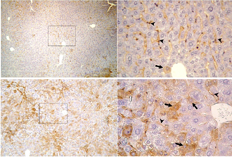 t1ihc t1ihc