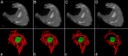 T2_Bild_3_Transverse nano-CT