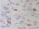 B2_Bild_3_Stammzellen-adipogene Differenzierung