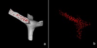 Osteocytes