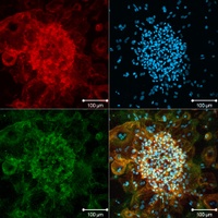 M3_Bild2_cLSM-Bild von Monozyten/Osteoklasten