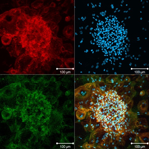 M3_Bild2_cLSM-Bild von Monozyten/Osteoklasten